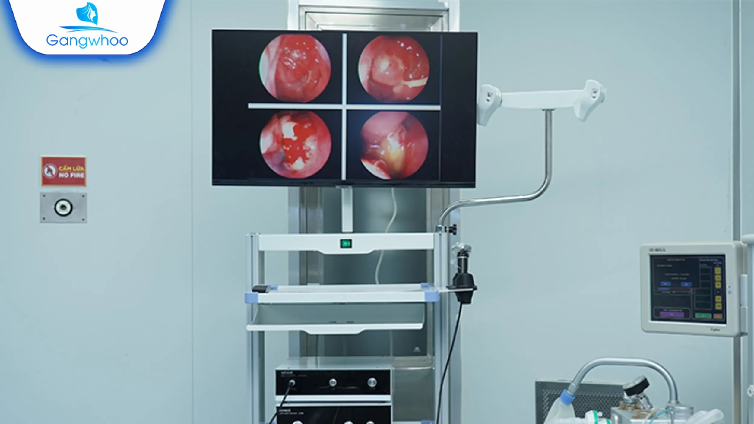 Giải Đáp: Sau Khi Căng Da Mặt Có Cần Nghỉ Làm Không?